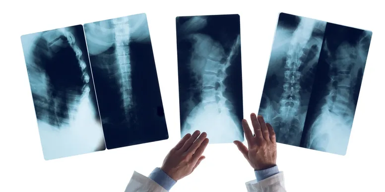 X-Ray Film